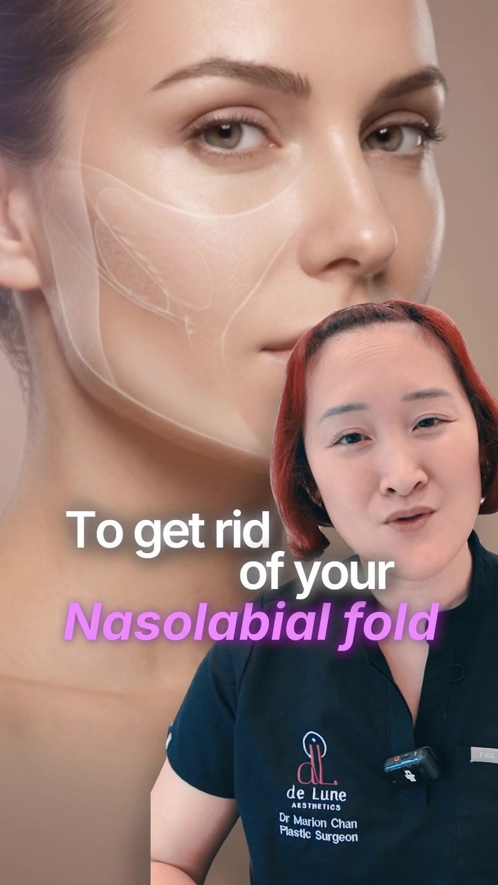 Your nasolabial fold is normal anatomy