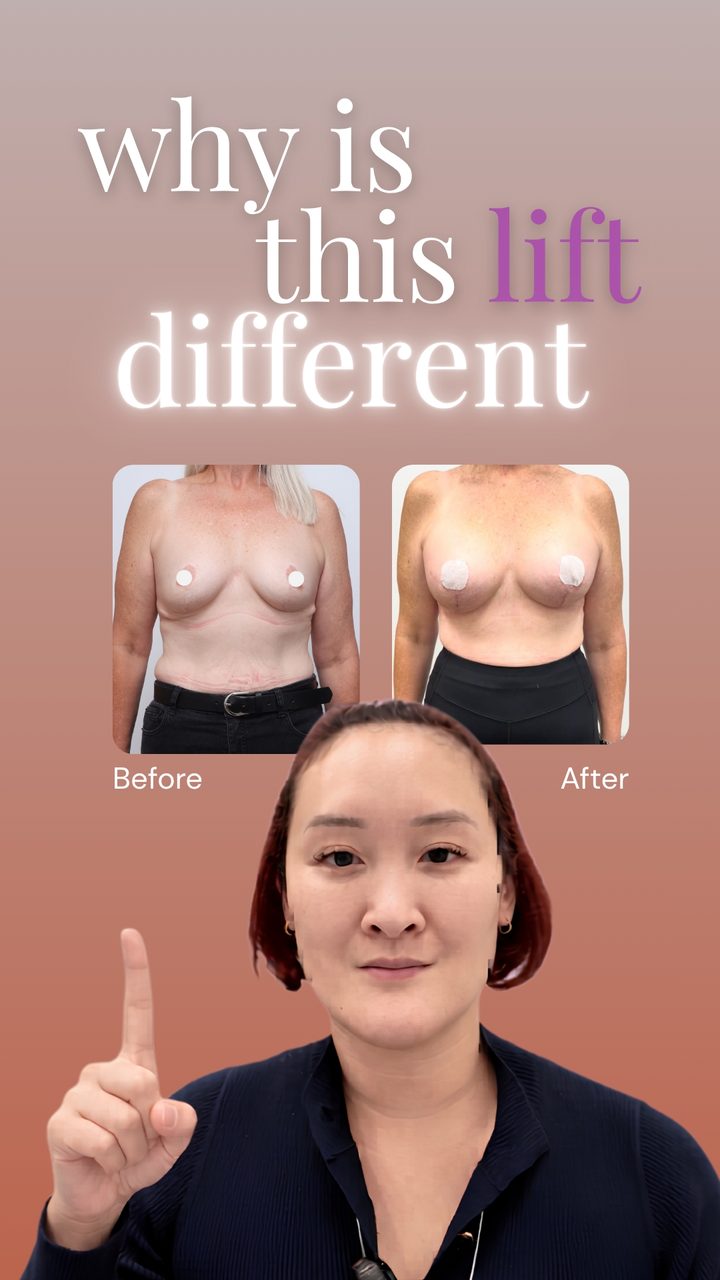 Why revision surgery exists